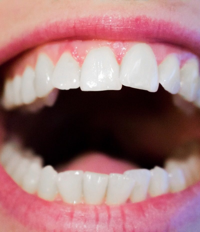 Nowoczesna technologia stosowana w salonach stomatologii estetycznej być może spowodować, że odbierzemy ładny uśmiech.